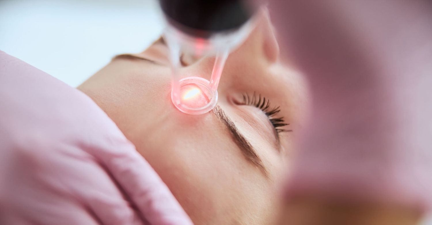 Laser treatment for skin rejuvenation procedure.