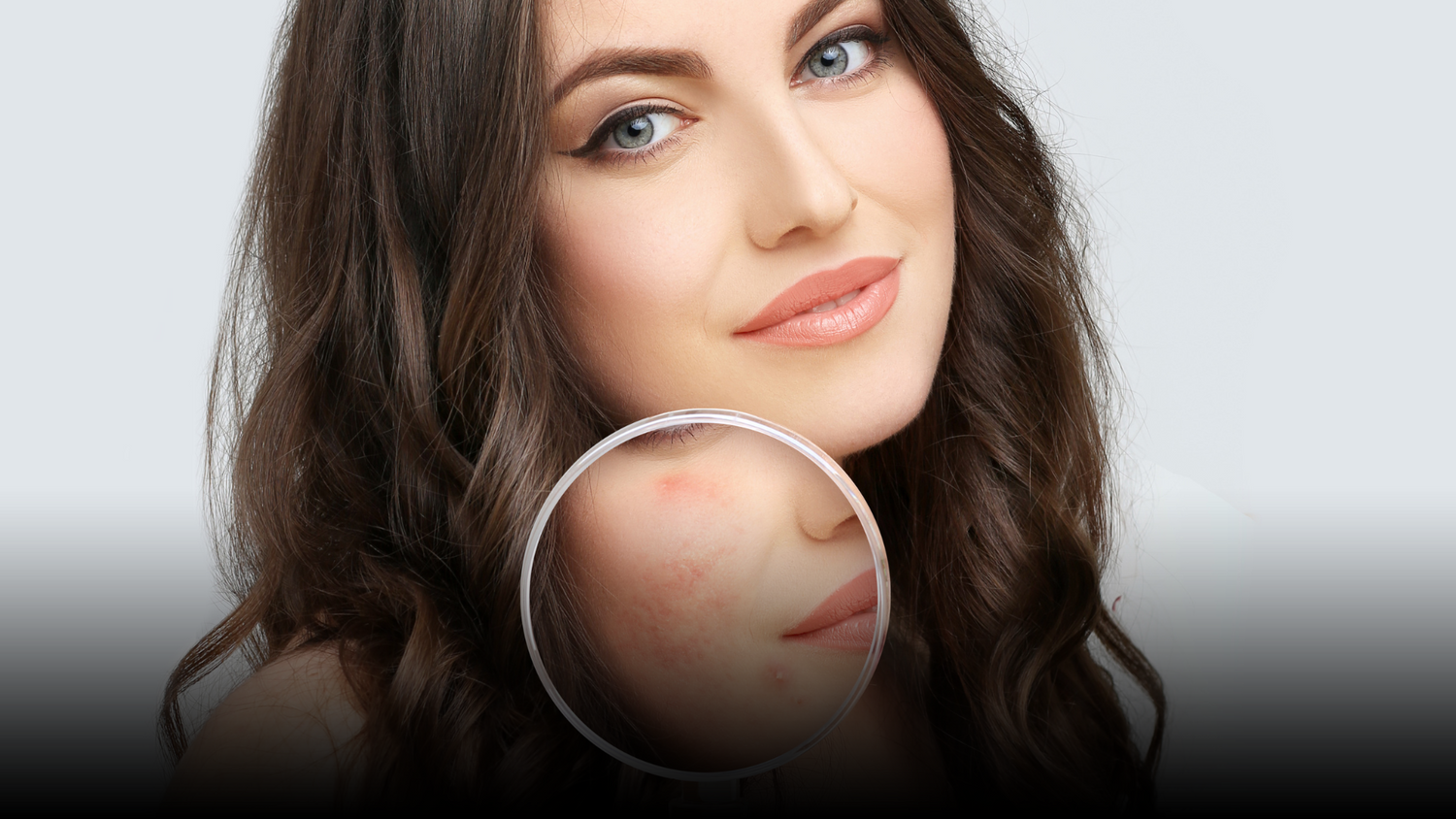 Woman's face with skin blemish magnified.